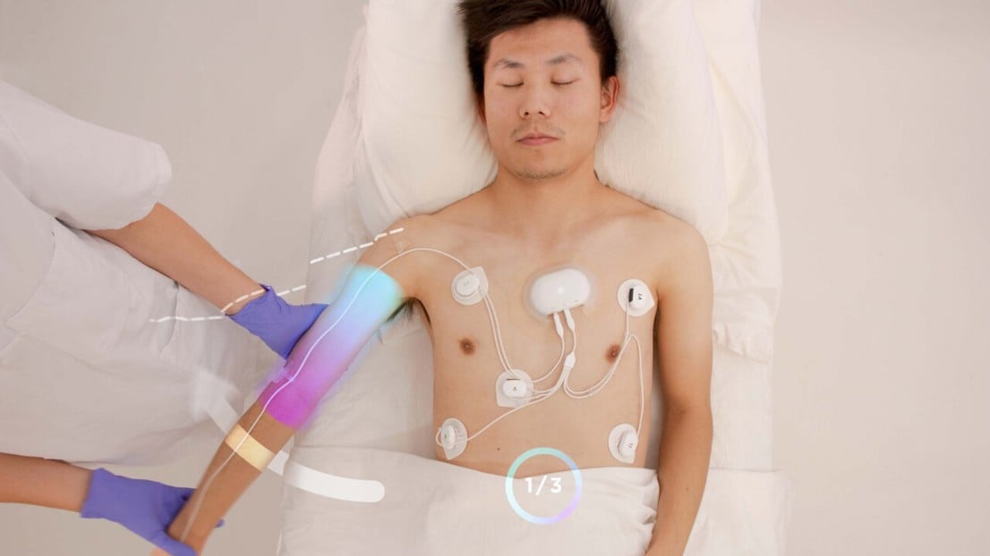 APD Future Intensive Care Monitoring